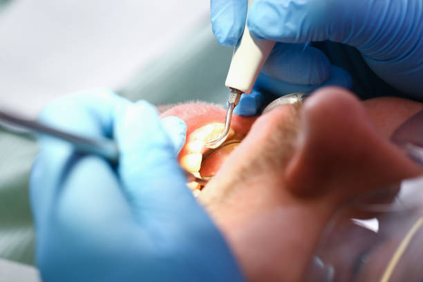 Best After-Hours Emergency Dentist in North Prairie, WI